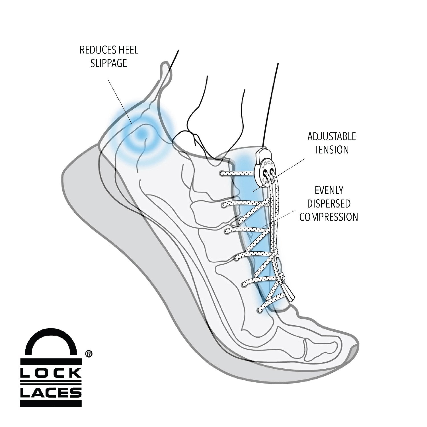 No Tie Lacing Systems For Arthritis And Joint Pain